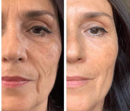 Reduce Fine Lines 60 ml Pack of 2