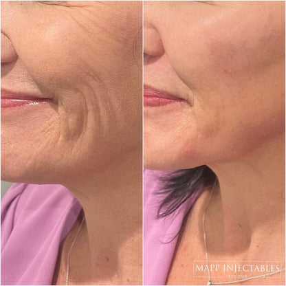 Reduce Fine Lines 60 ml Pack of 2